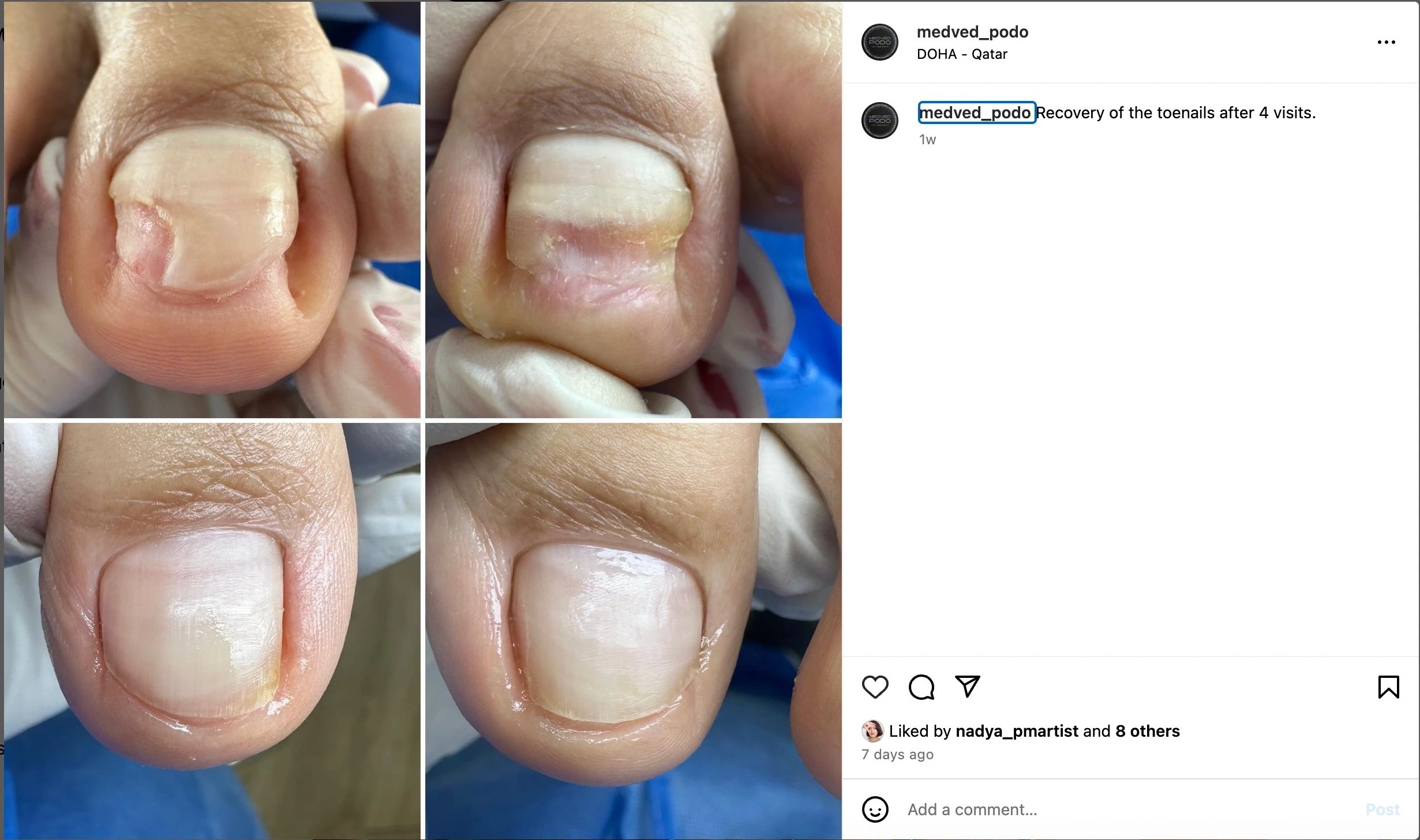 Before and after foot care session